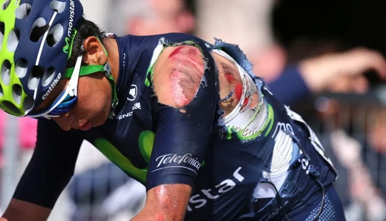 Травмы велосипедиста